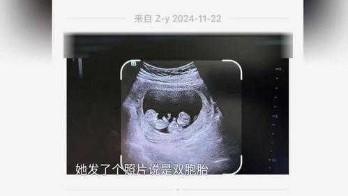 假怀孕照片,网络热议背后的真相与争议